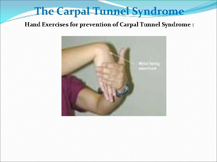 The Carpal Tunnel Syndrome Hand Exercises for prevention of Carpal Tunnel Syndrome : 