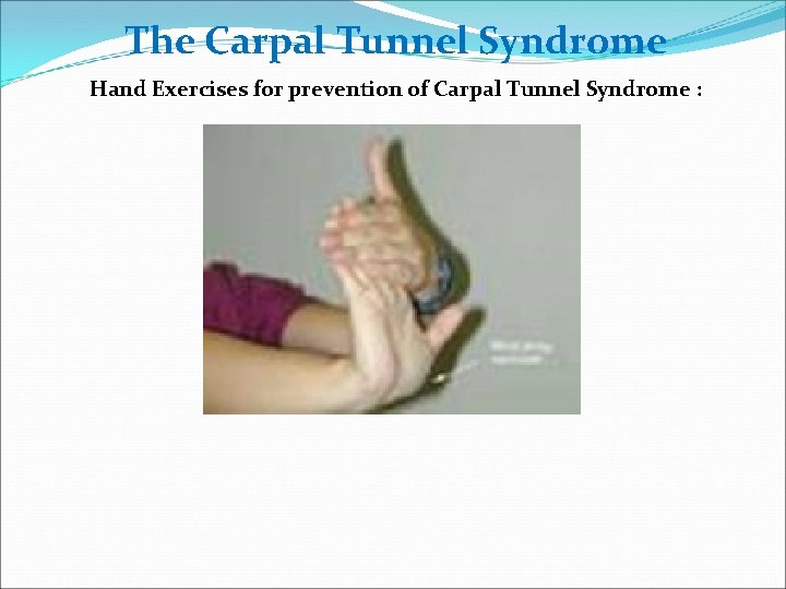 The Carpal Tunnel Syndrome Hand Exercises for prevention of Carpal Tunnel Syndrome : 