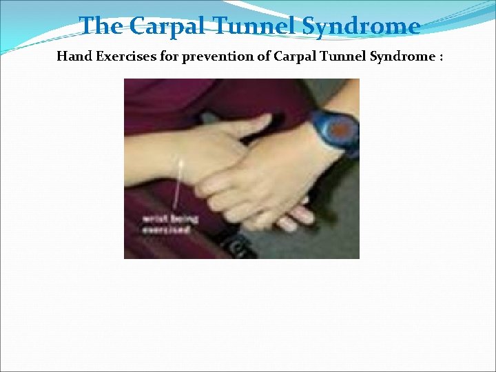 The Carpal Tunnel Syndrome Hand Exercises for prevention of Carpal Tunnel Syndrome : 