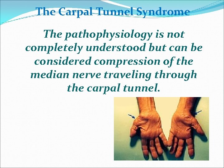 The Carpal Tunnel Syndrome The pathophysiology is not completely understood but can be considered