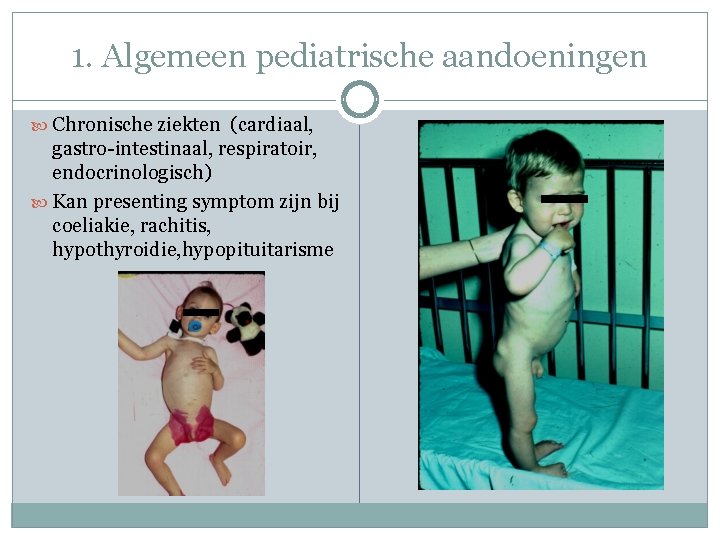1. Algemeen pediatrische aandoeningen Chronische ziekten (cardiaal, gastro-intestinaal, respiratoir, endocrinologisch) Kan presenting symptom zijn 1. Algemeen pediatrische aandoeningen Chronische ziekten (cardiaal, gastro-intestinaal, respiratoir, endocrinologisch) Kan presenting symptom zijn