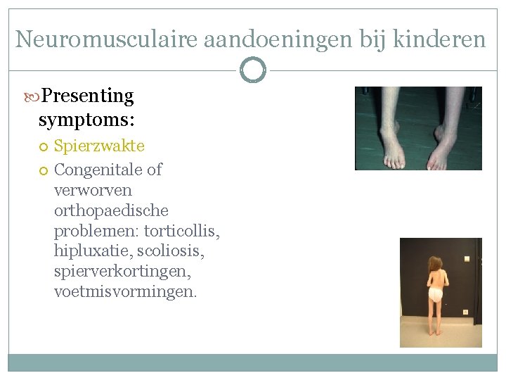 Neuromusculaire aandoeningen bij kinderen Presenting symptoms: Spierzwakte Congenitale of verworven orthopaedische problemen: torticollis, hipluxatie, Neuromusculaire aandoeningen bij kinderen Presenting symptoms: Spierzwakte Congenitale of verworven orthopaedische problemen: torticollis, hipluxatie,