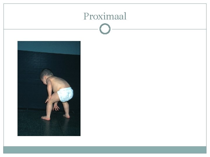 Proximaal Proximaal