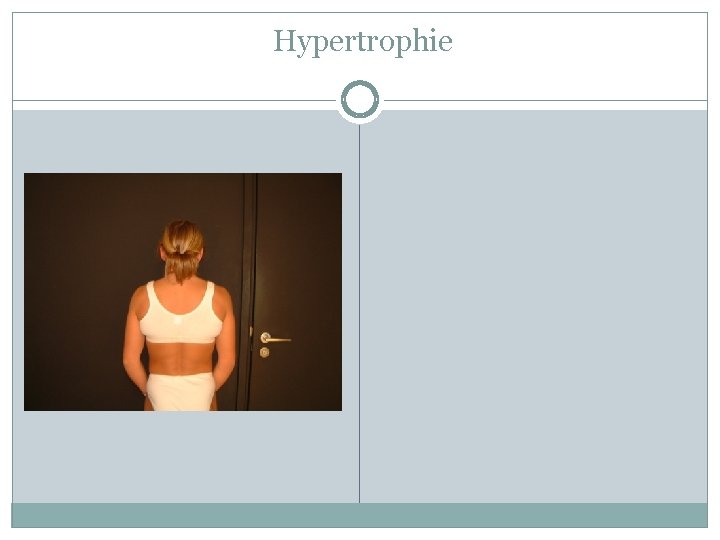 Hypertrophie Hypertrophie