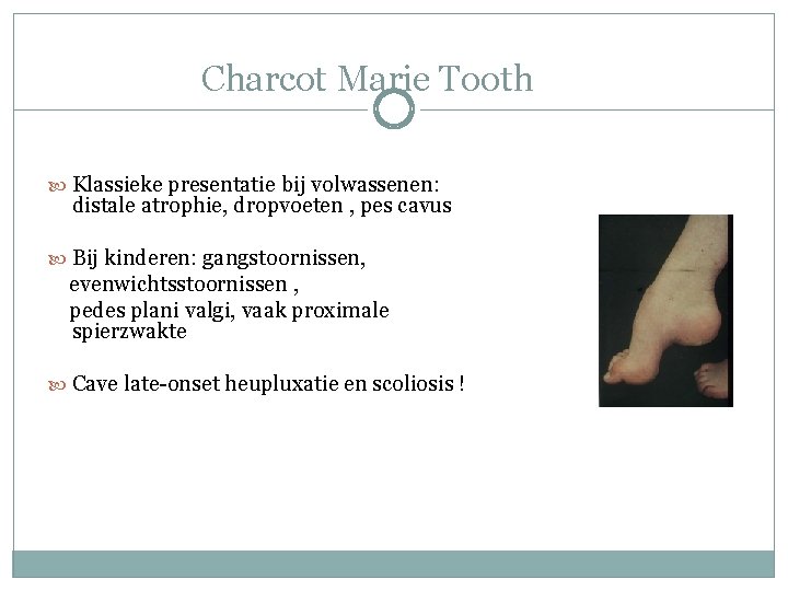 Charcot Marie Tooth Klassieke presentatie bij volwassenen: distale atrophie, dropvoeten , pes cavus Bij Charcot Marie Tooth Klassieke presentatie bij volwassenen: distale atrophie, dropvoeten , pes cavus Bij