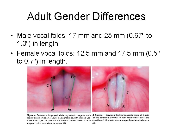 Adult Gender Differences • Male vocal folds: 17 mm and 25 mm (0. 67"