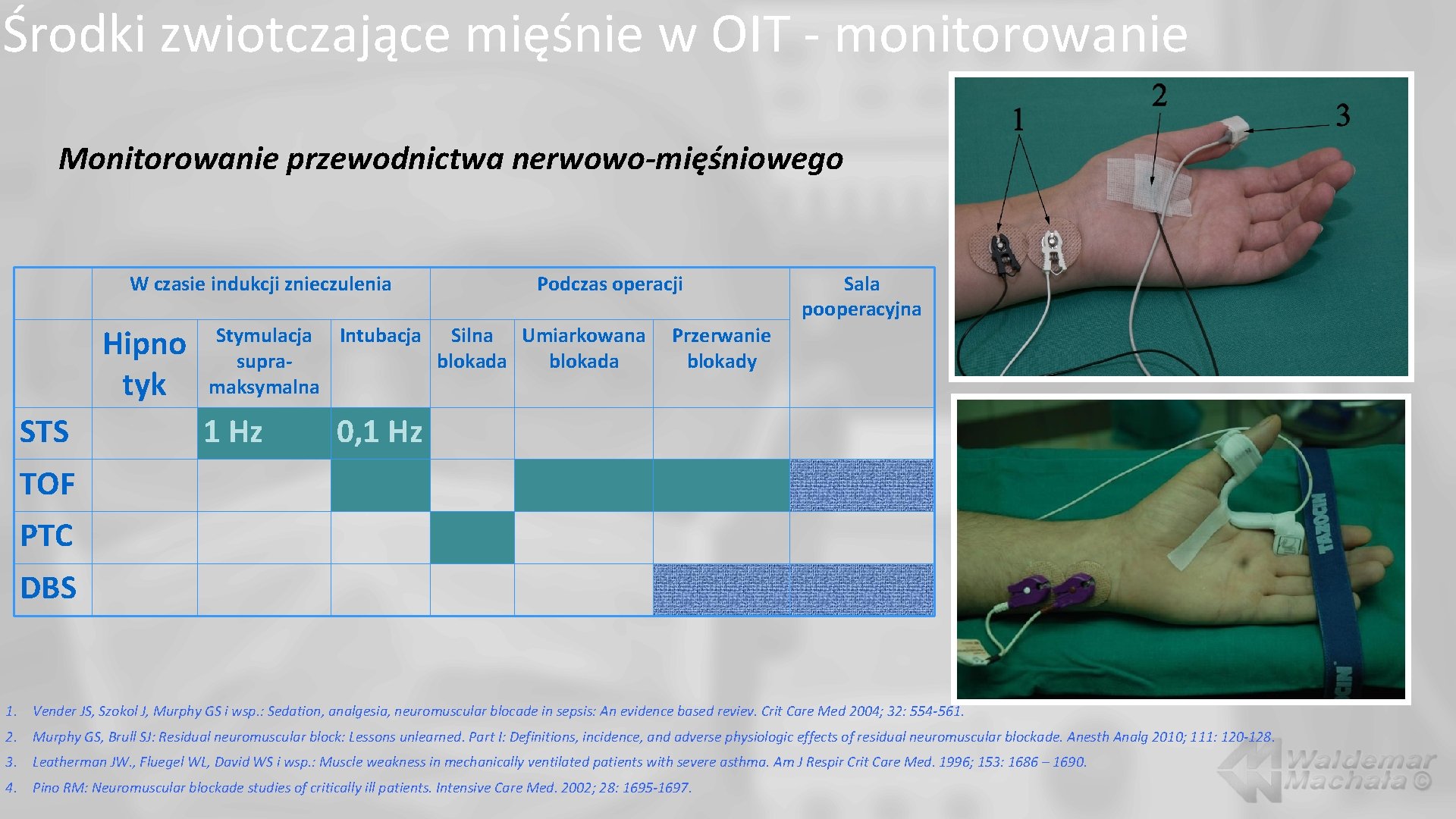 Środki zwiotczające mięśnie w OIT - monitorowanie Monitorowanie przewodnictwa nerwowo-mięśniowego W czasie indukcji znieczulenia