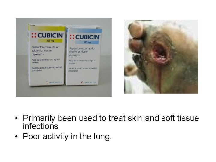 • Primarily been used to treat skin and soft tissue infections • Poor • Primarily been used to treat skin and soft tissue infections • Poor
