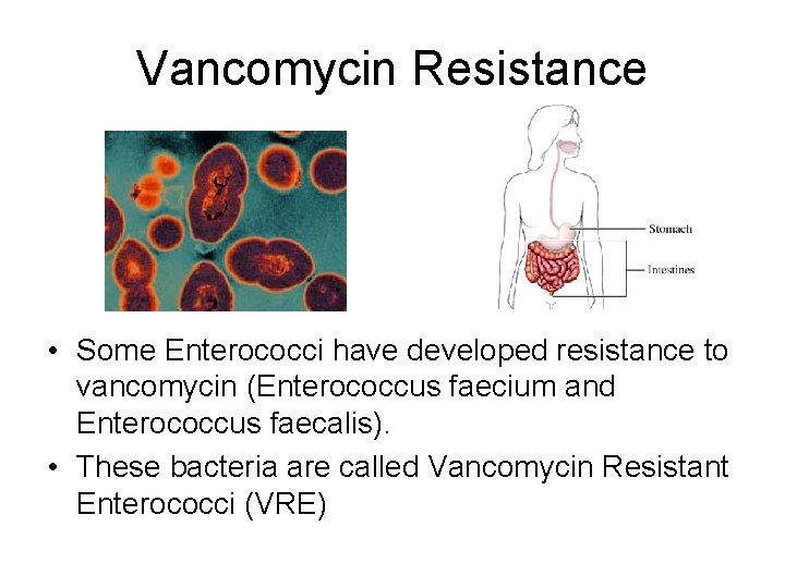 Vancomycin Resistance • Some Enterococci have developed resistance to vancomycin (Enterococcus faecium and Enterococcus Vancomycin Resistance • Some Enterococci have developed resistance to vancomycin (Enterococcus faecium and Enterococcus