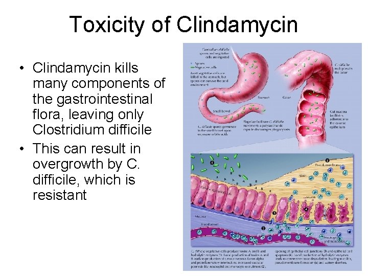 Toxicity of Clindamycin • Clindamycin kills many components of the gastrointestinal flora, leaving only Toxicity of Clindamycin • Clindamycin kills many components of the gastrointestinal flora, leaving only