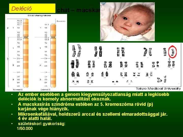 Deléció Cri du chat – macskasírás szindróma 5 • • Az ember esetében a