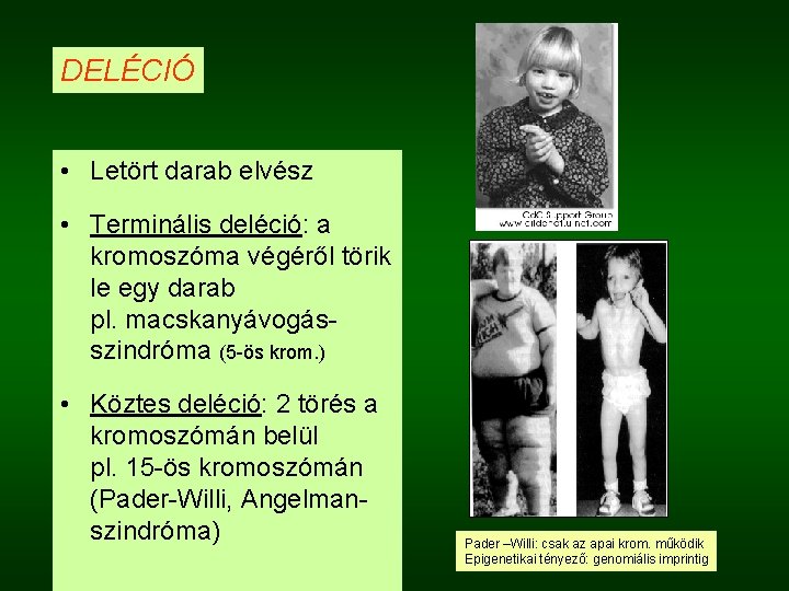 DELÉCIÓ • Letört darab elvész • Terminális deléció: a kromoszóma végéről törik le egy