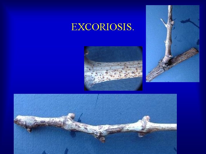 EXCORIOSIS. 