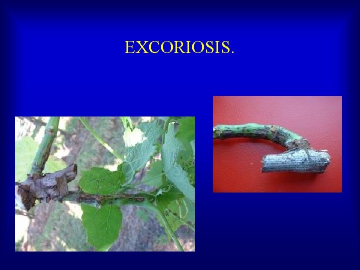 EXCORIOSIS. 