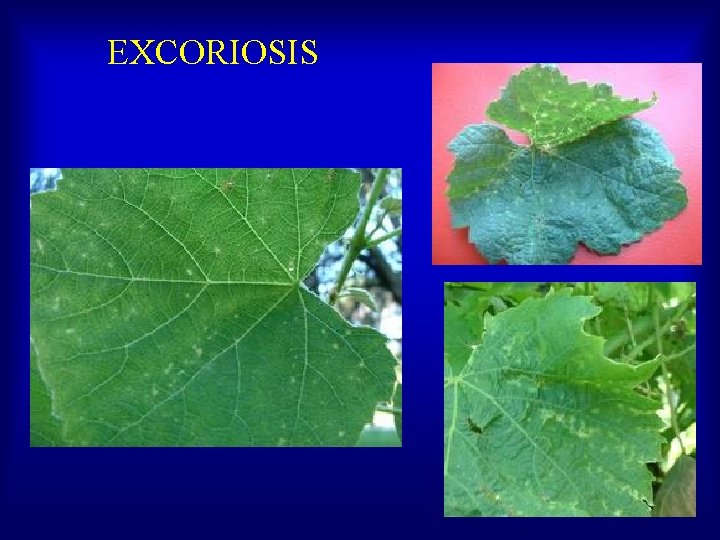 EXCORIOSIS 