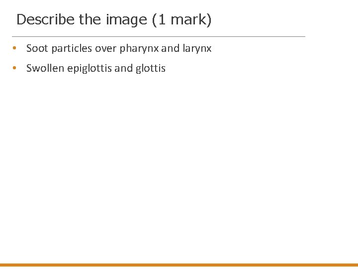 Describe the image (1 mark) • Soot particles over pharynx and larynx • Swollen