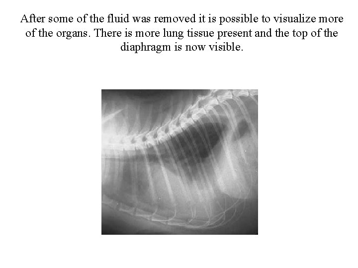 After some of the fluid was removed it is possible to visualize more of