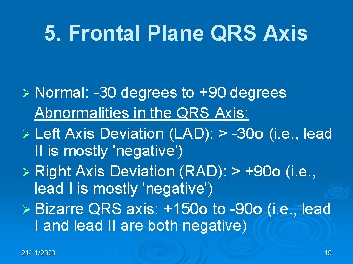 5. Frontal Plane QRS Axis Ø Normal: -30 degrees to +90 degrees Abnormalities in