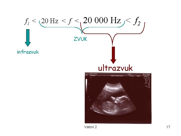 f 1 < 20 Hz < f < 20 000 Hz < f 2