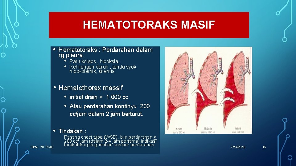 HEMATOTORAKS MASIF • Hematotoraks : Perdarahan dalam rg pleura. • Paru kolaps , hipoksia,