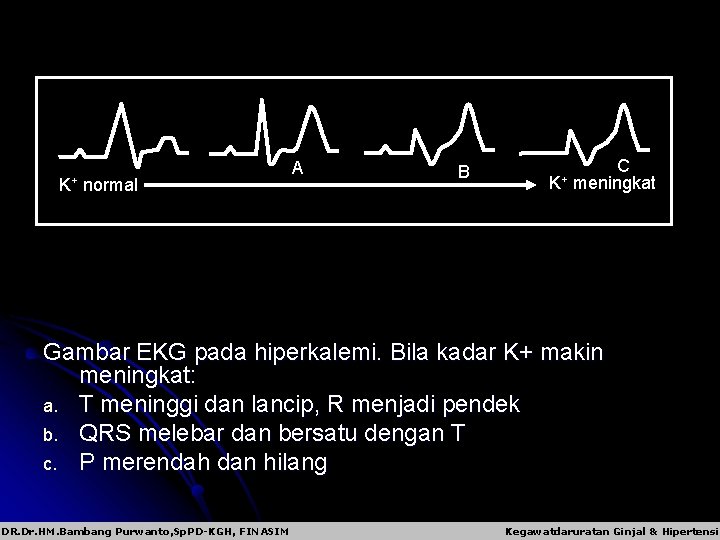 K+ normal A B C K+ meningkat Gambar EKG pada hiperkalemi. Bila kadar K+