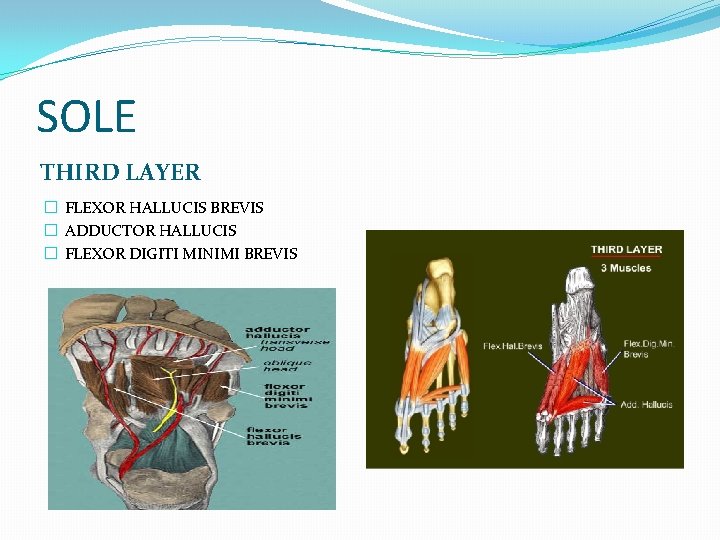 SOLE THIRD LAYER � FLEXOR HALLUCIS BREVIS � ADDUCTOR HALLUCIS � FLEXOR DIGITI MINIMI