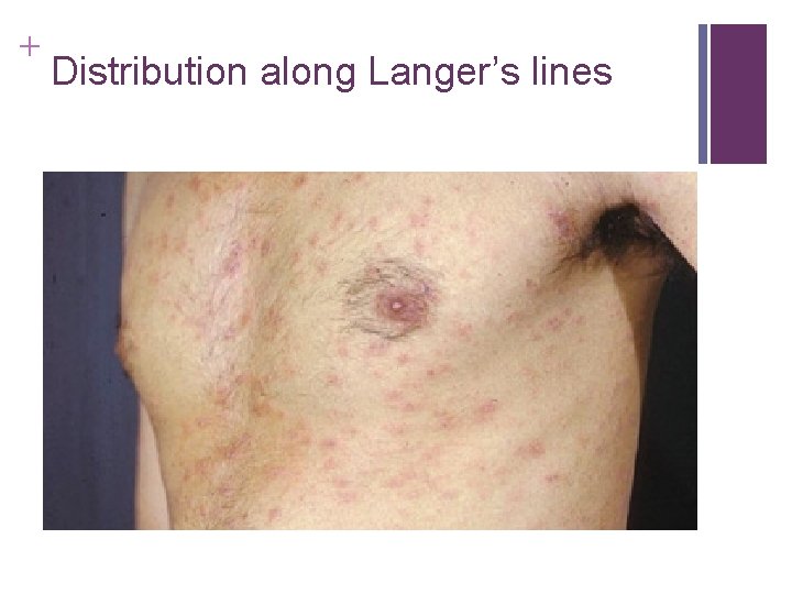+ Distribution along Langer’s lines + Distribution along Langer’s lines