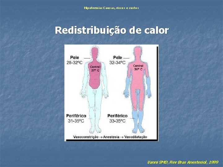 Hipotermia: Causas, riscos e custos Redistribuição de calor Vanni SMD, Rev Bras Anestesiol, 1999