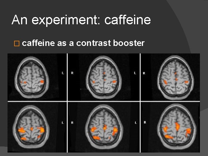 An experiment: caffeine � caffeine as a contrast booster 