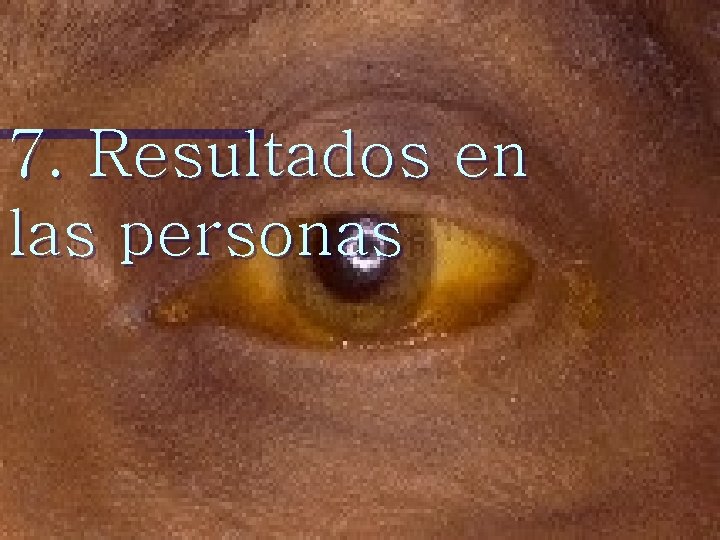 7. Resultados en las personas 