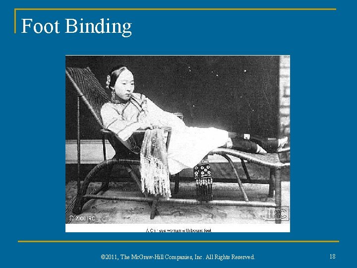 Foot Binding © 2011, The Mc. Graw-Hill Companies, Inc. All Rights Reserved. 18 
