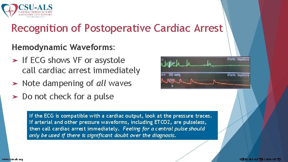 Recognition of Postoperative Cardiac Arrest Hemodynamic Waveforms: ➤ If ECG shows VF or asystole
