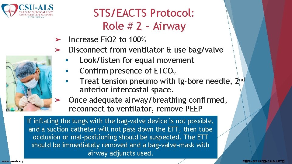 STS/EACTS Protocol: Role # 2 - Airway Increase Fi. O 2 to 100% Disconnect