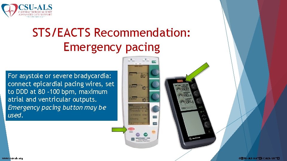 STS/EACTS Recommendation: Emergency pacing For asystole or severe bradycardia: connect epicardial pacing wires, set