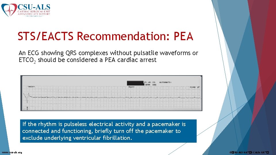 STS/EACTS Recommendation: PEA An ECG showing QRS complexes without pulsatile waveforms or ETCO 2