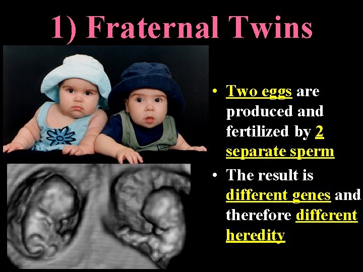 1) Fraternal Twins • Two eggs are produced and fertilized by 2 separate sperm 1) Fraternal Twins • Two eggs are produced and fertilized by 2 separate sperm