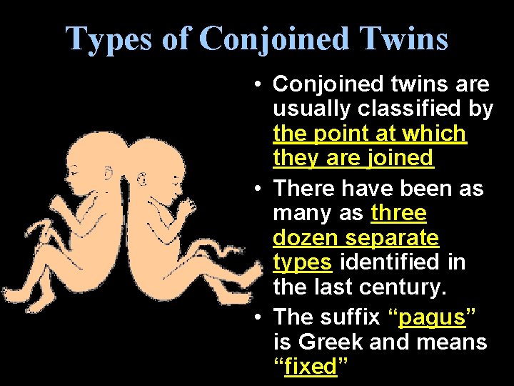 Types of Conjoined Twins • Conjoined twins are usually classified by the point at Types of Conjoined Twins • Conjoined twins are usually classified by the point at