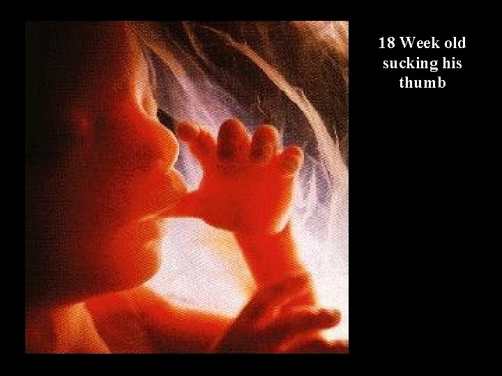 18 Week old sucking his thumb 18 Week old sucking his thumb