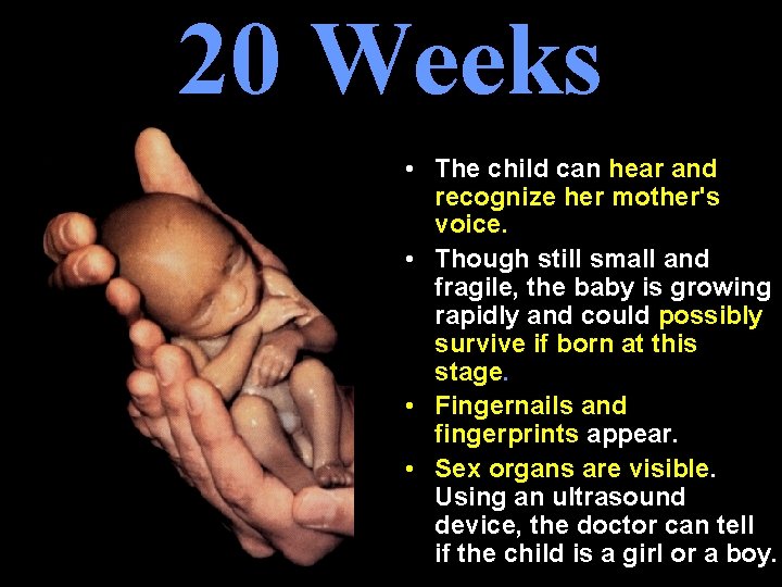 20 Weeks • The child can hear and recognize her mother's voice. • Though 20 Weeks • The child can hear and recognize her mother's voice. • Though