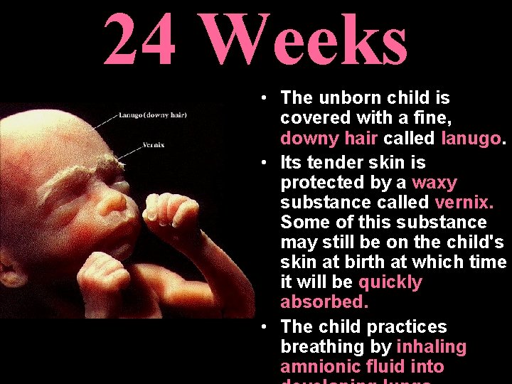 24 Weeks • The unborn child is covered with a fine, downy hair called 24 Weeks • The unborn child is covered with a fine, downy hair called