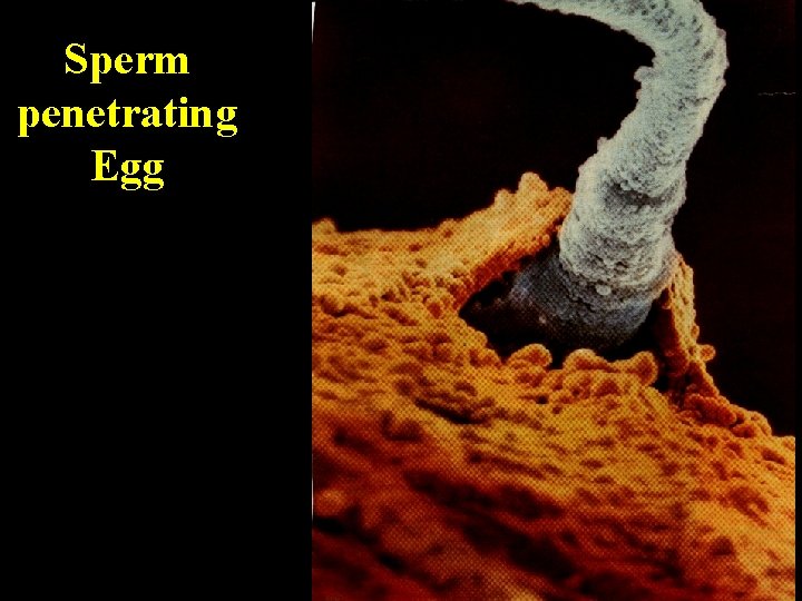 Sperm penetrating Egg Sperm penetrating Egg