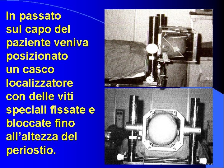 In passato sul capo del paziente veniva posizionato un casco localizzatore con delle viti