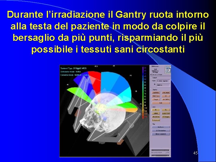 Durante l’irradiazione il Gantry ruota intorno alla testa del paziente in modo da colpire