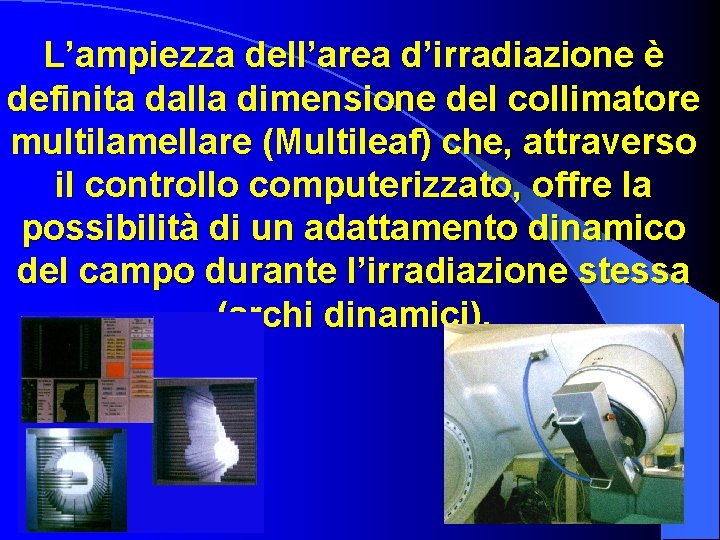 L’ampiezza dell’area d’irradiazione è definita dalla dimensione del collimatore multilamellare (Multileaf) che, attraverso il