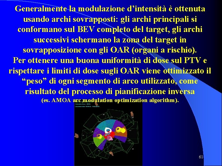 Generalmente la modulazione d’intensità è ottenuta usando archi sovrapposti: gli archi principali si conformano