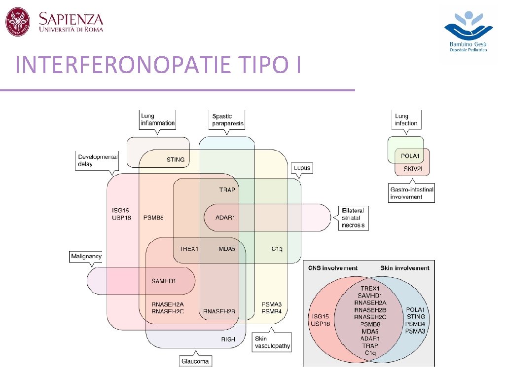 INTERFERONOPATIE TIPO I 