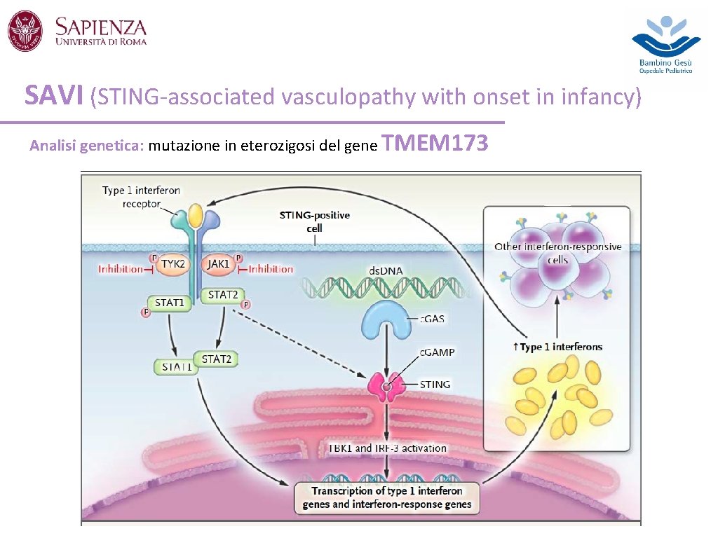 SAVI (STING-associated vasculopathy with onset in infancy) Analisi genetica: mutazione in eterozigosi del gene