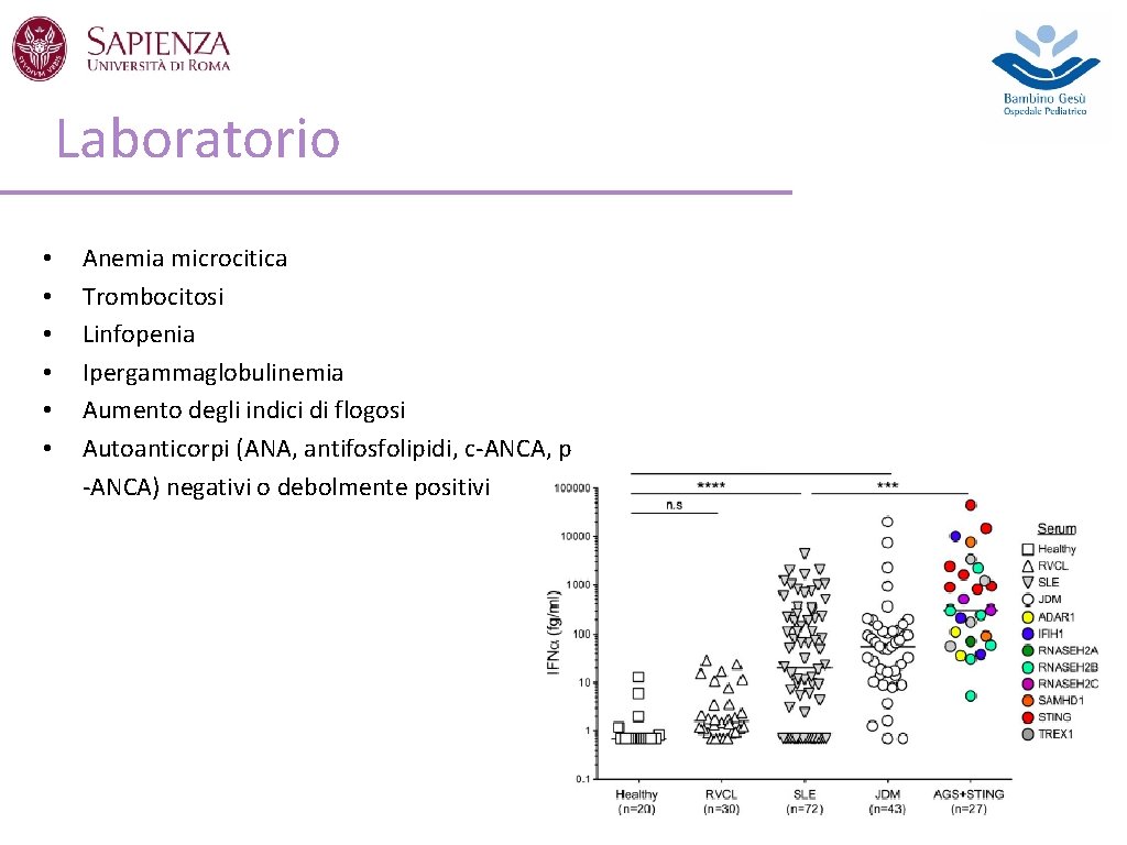 Laboratorio • • • Anemia microcitica Trombocitosi Linfopenia Ipergammaglobulinemia Aumento degli indici di flogosi