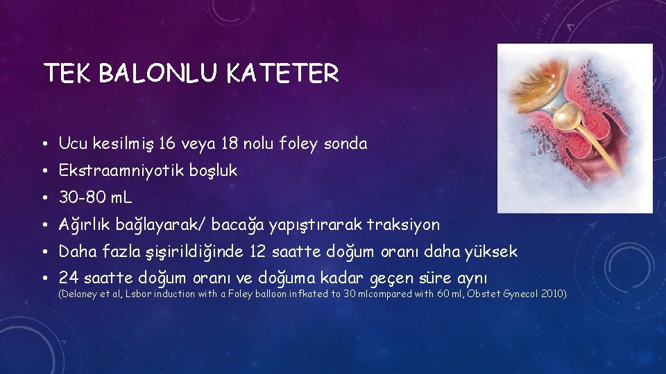 TEK BALONLU KATETER • Ucu kesilmiş 16 veya 18 nolu foley sonda • Ekstraamniyotik