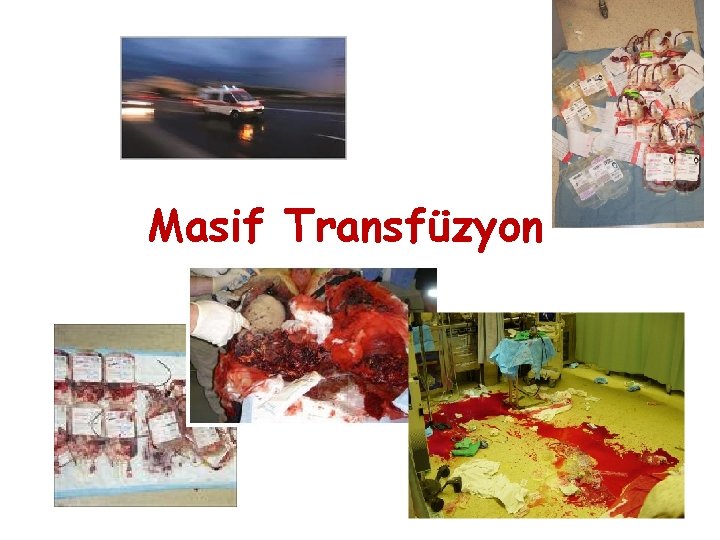 Masif Transfüzyon 